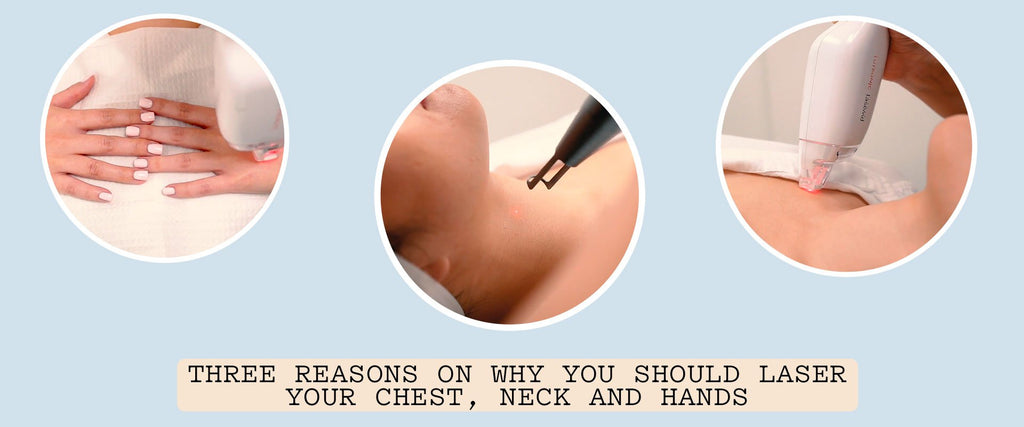Three Reasons on Why You Should Laser Your Chest, Neck and Hands